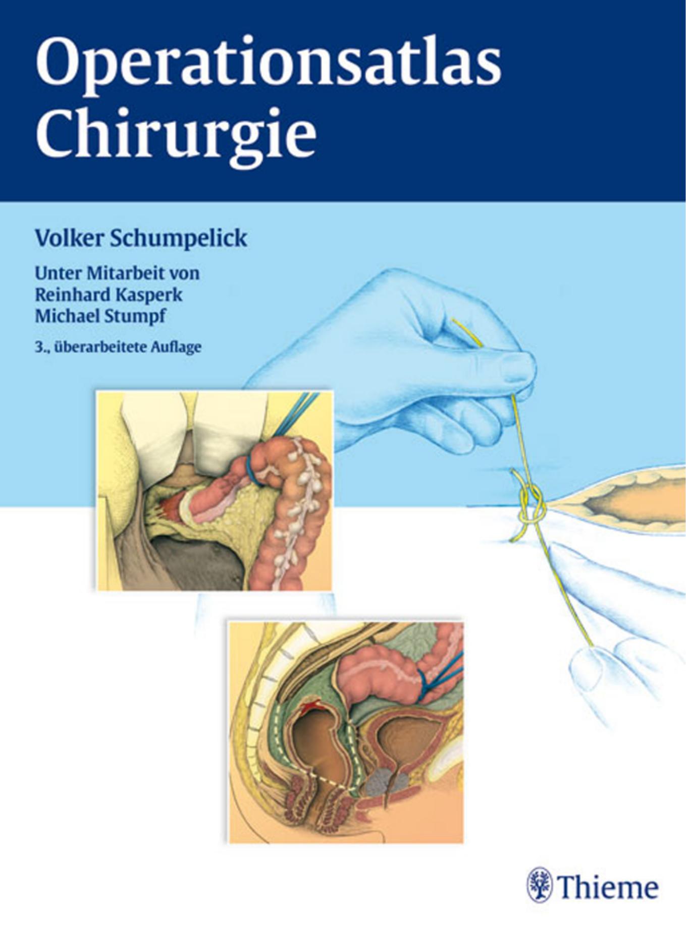 Operationsatlas Chirurgie